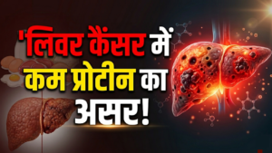 कम प्रोटीन आहार से लिवर ट्यूमर की वृद्धि धीमी हो सकती है